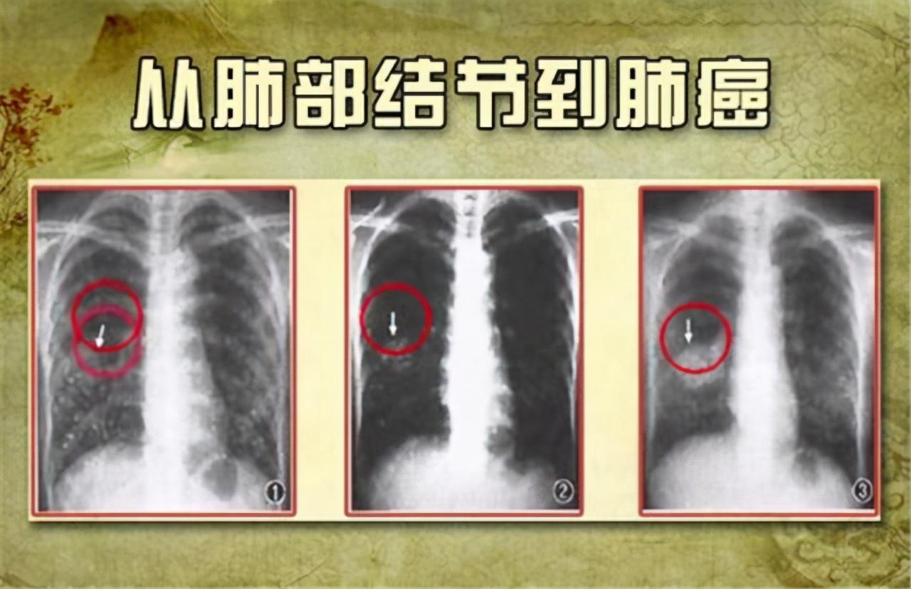 今期狗猴龙出特,四不两立长恨丽代表是指什么生肖，详细解答、专家解答解释落实